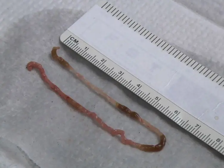 Tissue Engineering of the Intestine in a Murine Model