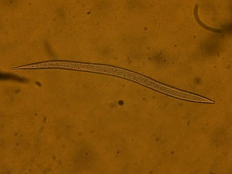 Visualizing Bacteria in Nematodes using Fluorescent Microscopy