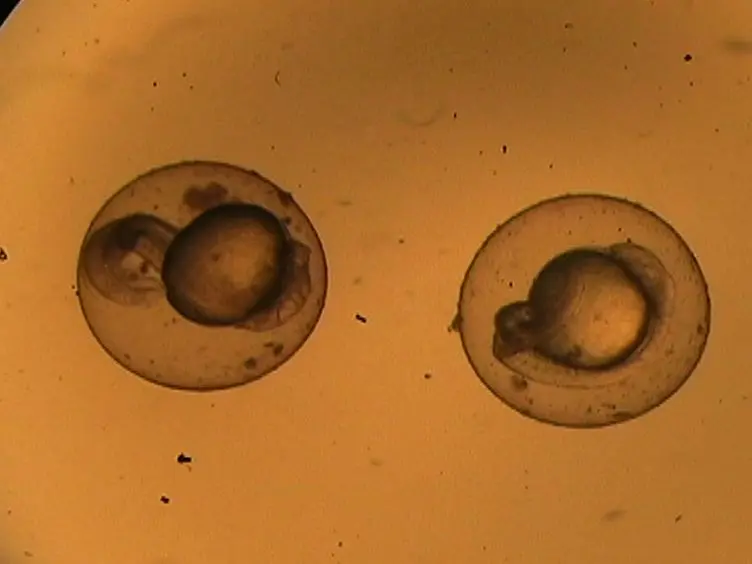 Metabolic Profile Analysis of Zebrafish Embryos