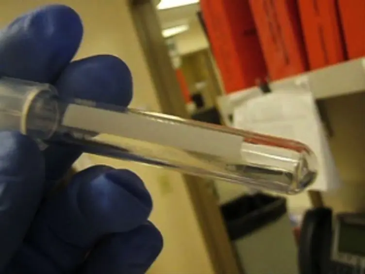 Enumeration of Major Peripheral Blood Leukocyte Populations for Multicenter Clinical Trials Using a Whole Blood Phenotyping Assay