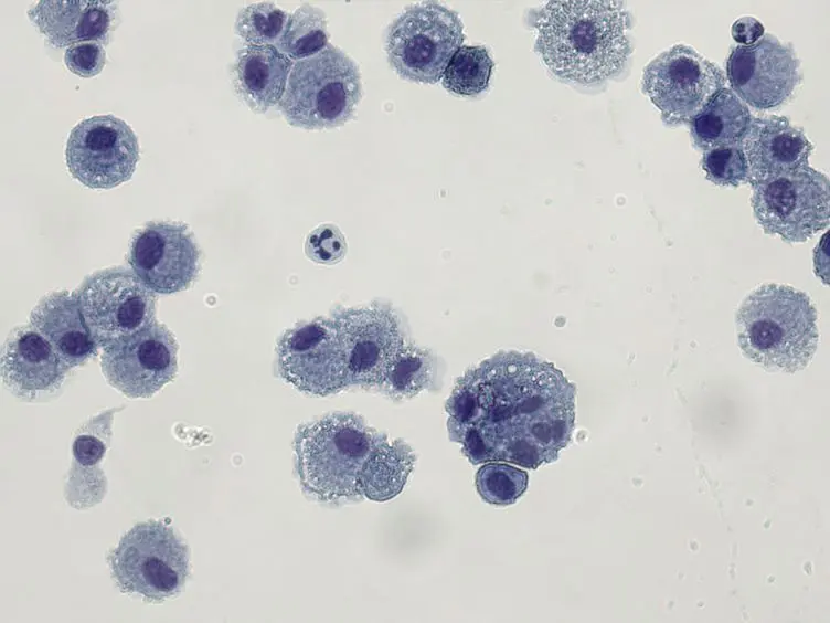 Bronchoalveolar Lavage (BAL) for Research; Obtaining Adequate Sample Yield