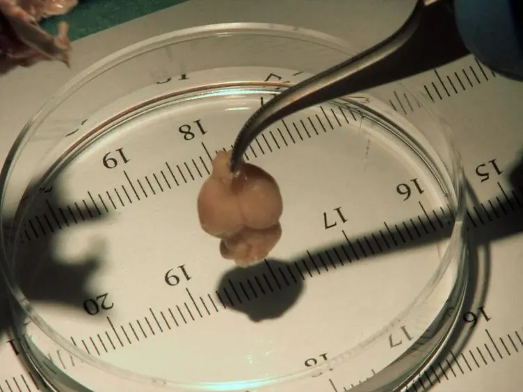 Intravascular Perfusion of Carbon Black Ink Allows Reliable Visualization of Cerebral Vessels