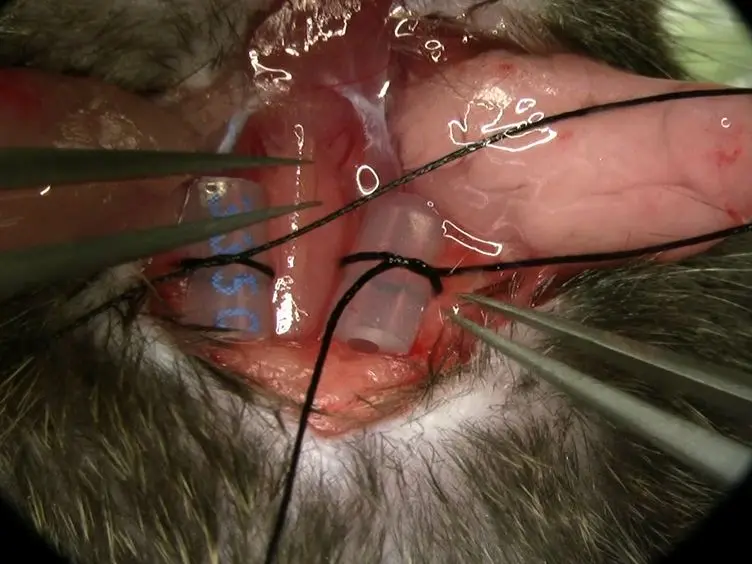 Bilateral Common Carotid Artery Occlusion as an Adequate Preconditioning Stimulus to Induce Early Ischemic Tolerance to Focal Cerebral Ischemia