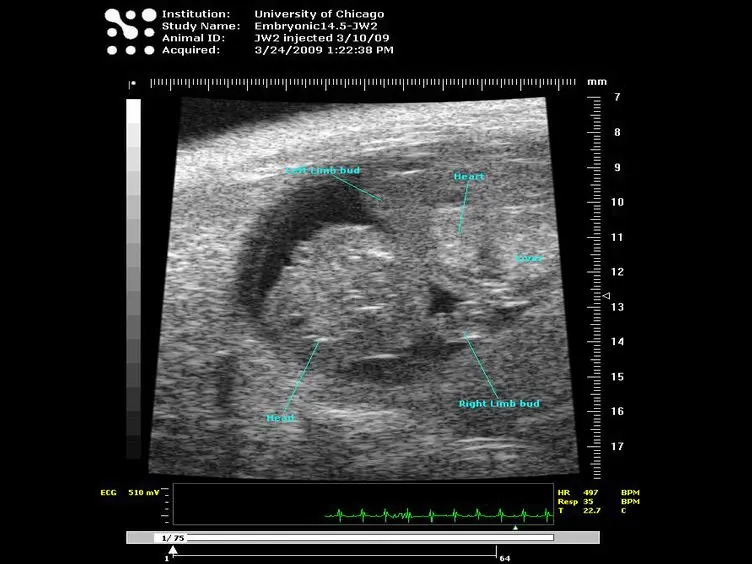 Murine Fetal Echocardiography