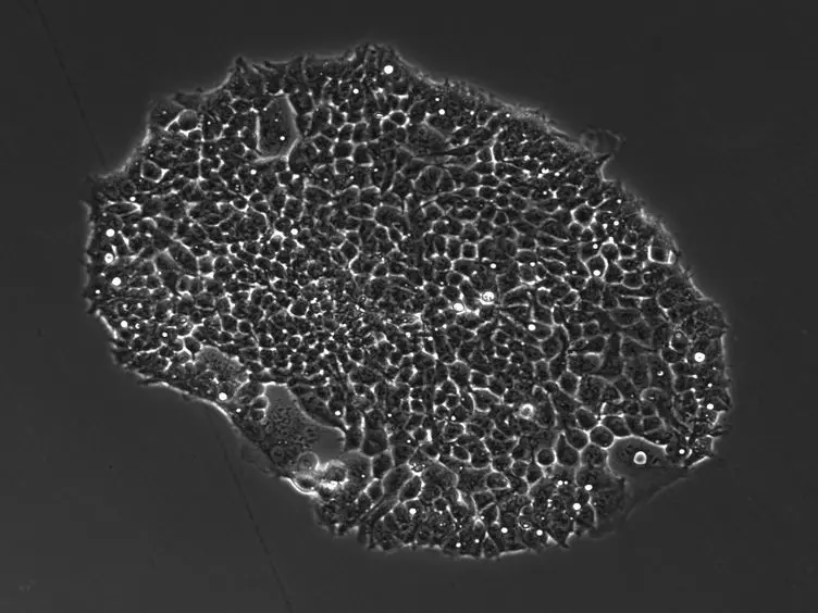 Preparation of Cell-lines for Conditional Knockdown of Gene Expression and Measurement of the Knockdown Effects on E4orf4-Induced Cell Death