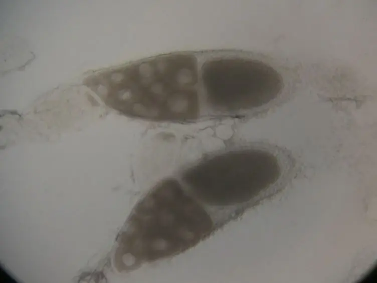 Live Imaging of GFP-labeled Proteins in <em>Drosophila</em> Oocytes