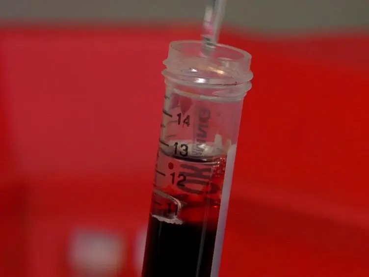 <em>Staphylococcus aureus</em> Growth using Human Hemoglobin as an Iron Source