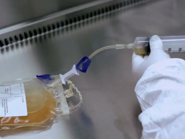 Preparation of Tumor Antigen-loaded Mature Dendritic Cells for Immunotherapy