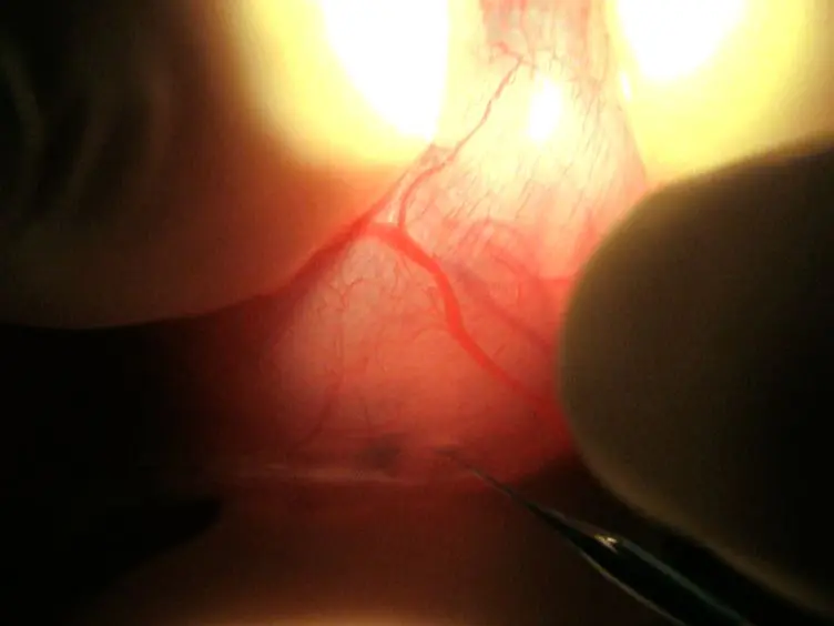 Generation of Topically Transgenic Rats by <em>In utero</em> Electroporation and <em>In vivo</em> Bioluminescence Screening