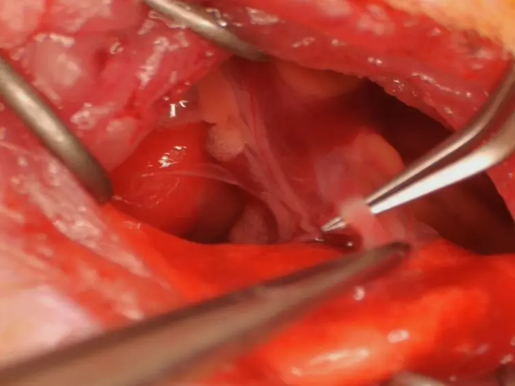Angiogenesis in the Ischemic Rat Lung