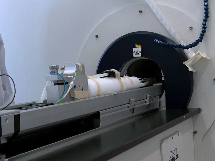 Monitoring Dendritic Cell Migration using <sup>19</sup>F / <sup>1</sup>H Magnetic Resonance Imaging