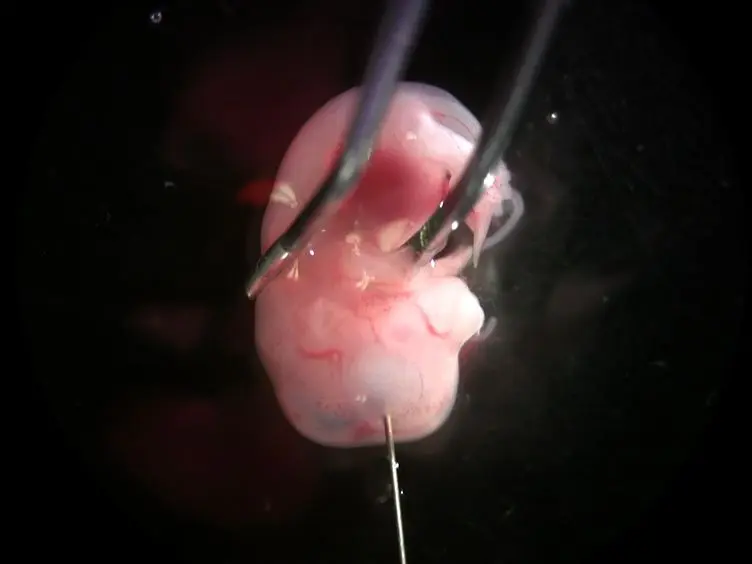 <em>Ex utero</em> Electroporation and Whole Hemisphere Explants: A Simple Experimental Method for Studies of Early Cortical Development