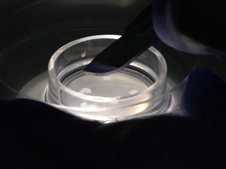 Post-embedding Immunogold Labeling of Synaptic Proteins in Hippocampal Slice Cultures