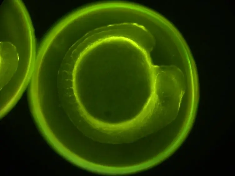 Generation of Dispersed Presomitic Mesoderm Cell Cultures for Imaging of the Zebrafish Segmentation Clock in Single Cells