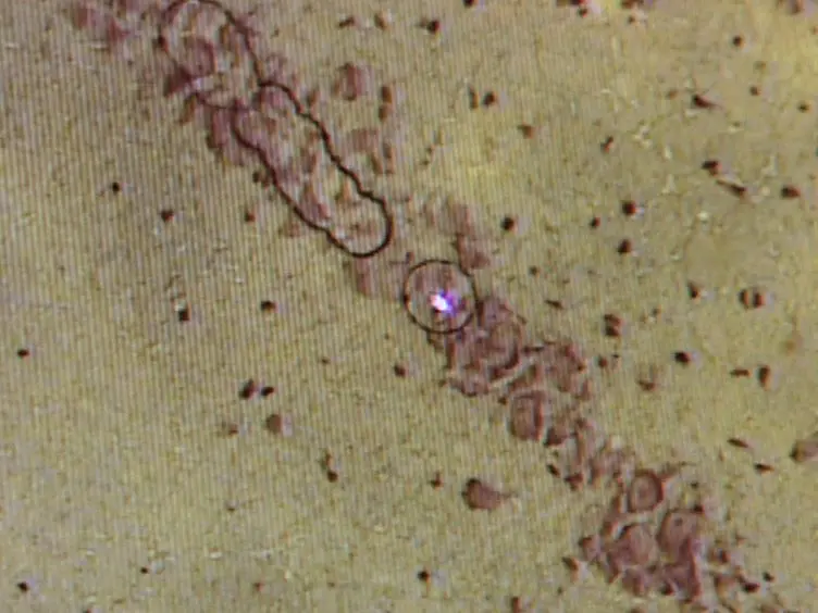 Laser Capture Microdissection of Enriched Populations of Neurons or Single Neurons for Gene Expression Analysis After Traumatic Brain Injury