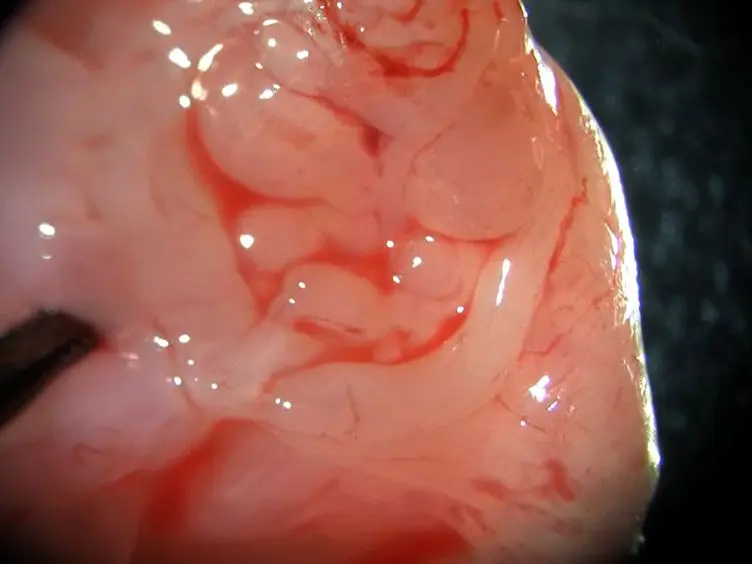 Formation of Human Prostate Epithelium Using Tissue Recombination of Rodent Urogenital Sinus Mesenchyme and Human Stem Cells