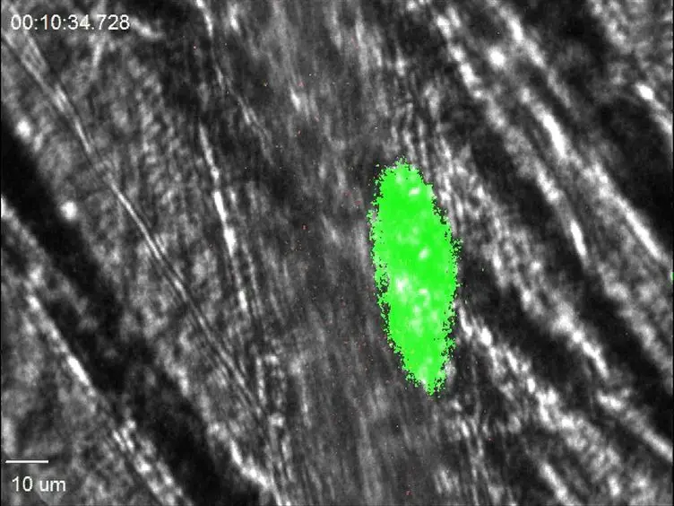 Real-time Imaging of Heterotypic Platelet-neutrophil Interactions on the Activated Endothelium During Vascular Inflammation and Thrombus Formation in Live Mice