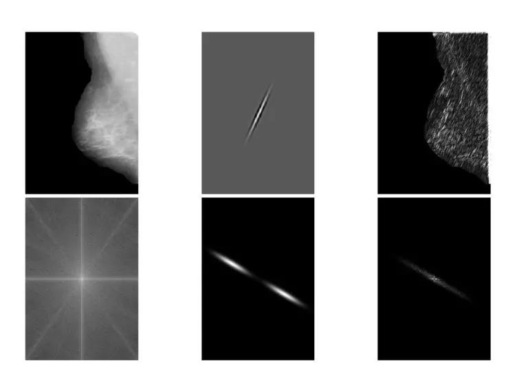 Detection of Architectural Distortion in Prior Mammograms <em>via</em> Analysis of Oriented Patterns