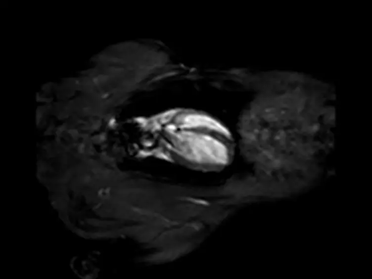 Assessment of Cardiac Function and Myocardial Morphology Using Small Animal Look-locker Inversion Recovery (SALLI) MRI in Rats