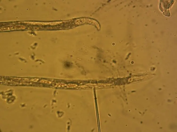 A <em>Caenorhabditis elegans</em> Model System for Amylopathy Study
