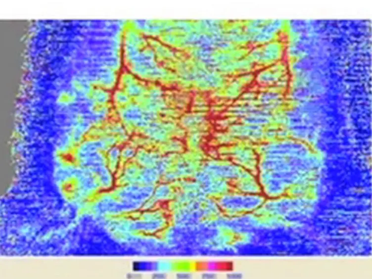 <em>In situ</em> Transverse Rectus Abdominis Myocutaneous Flap: A Rat Model of Myocutaneous Ischemia Reperfusion Injury