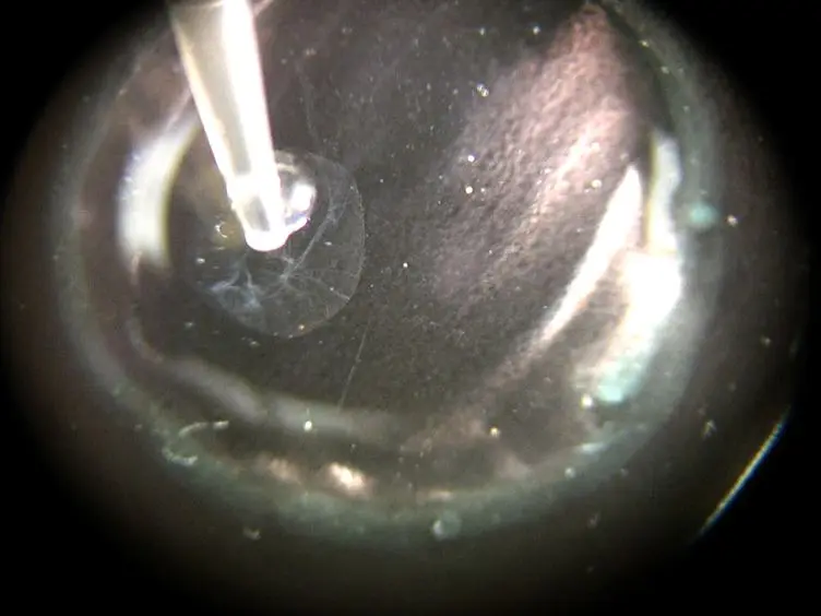 Trypsin Digest Protocol to Analyze the Retinal Vasculature of a Mouse Model