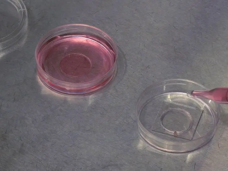 Live Imaging Assay for Assessing the Roles of Ca<sup>2+</sup> and Sphingomyelinase in the Repair of Pore-forming Toxin Wounds