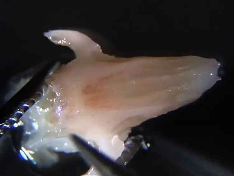 An Effective Manual Deboning Method To Prepare Intact Mouse Nasal Tissue With Preserved Anatomical Organization