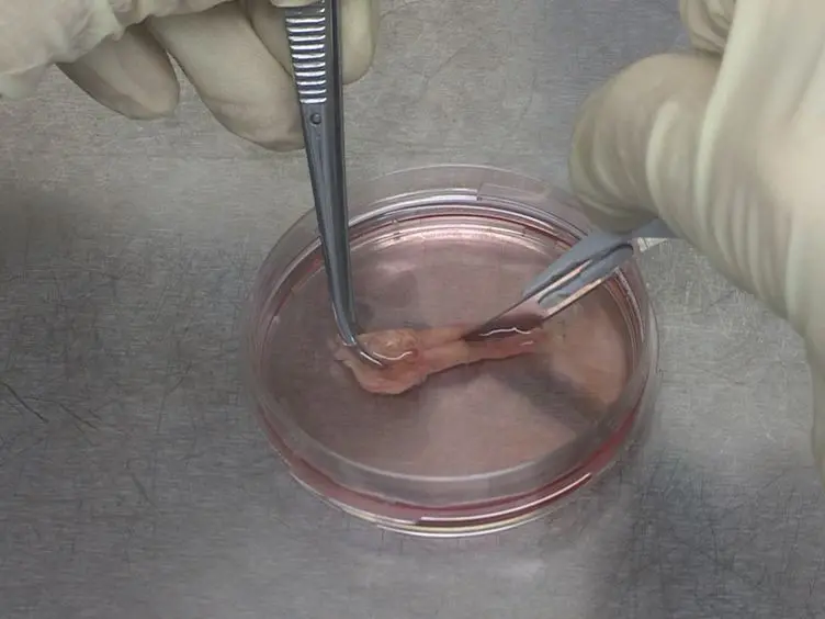 A Human <em>Ex Vivo</em> Atherosclerotic Plaque Model to Study Lesion Biology