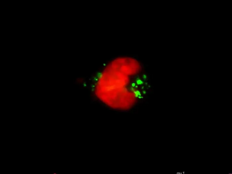 Cell Death Associated with Abnormal Mitosis Observed by Confocal Imaging in Live Cancer Cells