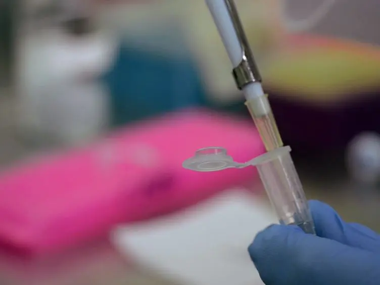 Use of Image Cytometry for Quantification of Pathogenic Fungi in Association with Host Cells