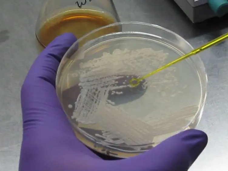 Establishment of an <em>In vitro</em> System to Study Intracellular Behavior of <em>Candida glabrata</em> in Human THP-1 Macrophages