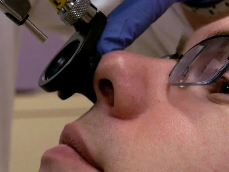 Culturing of Human Nasal Epithelial Cells at the Air Liquid Interface