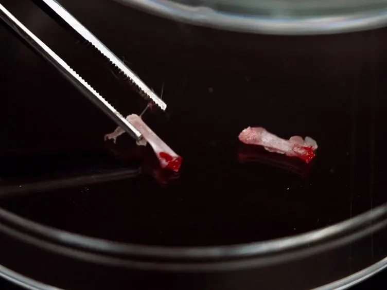 Pre-clinical Evaluation of Tyrosine Kinase Inhibitors for Treatment of Acute Leukemia