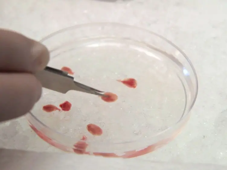 Isolation, Culture, and Transplantation of Muscle Satellite Cells