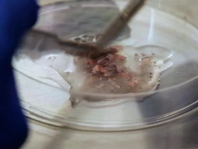 Isolation of Pulmonary Artery Smooth Muscle Cells from Neonatal Mice