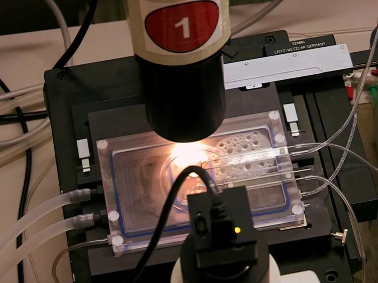 Videomorphometric Analysis of Hypoxic Pulmonary Vasoconstriction of Intra-pulmonary Arteries Using Murine Precision Cut Lung Slices