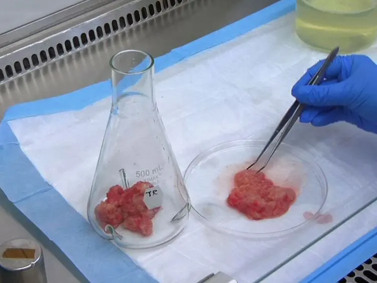 Isolation of Cellular Lipid Droplets: Two Purification Techniques Starting from Yeast Cells and Human Placentas