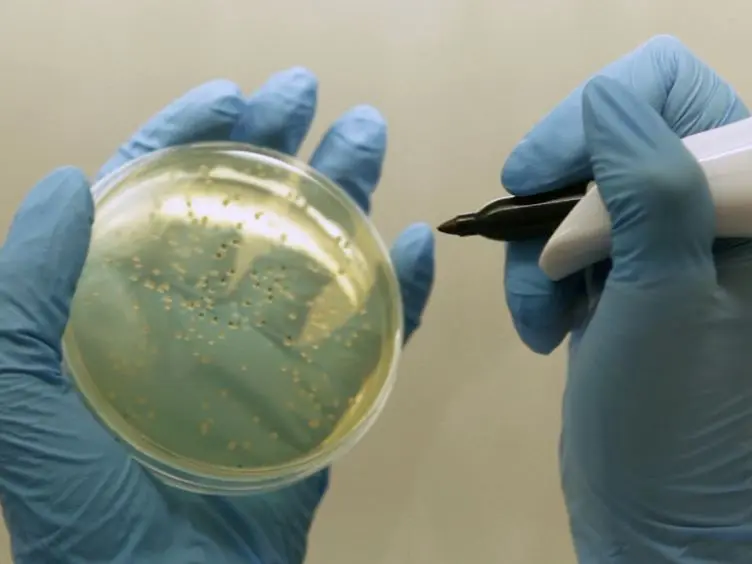 Long Term Chronic <em>Pseudomonas aeruginosa</em> Airway Infection in Mice