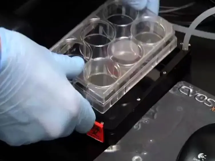 <em>In vitro</em> Cell Migration and Invasion Assays