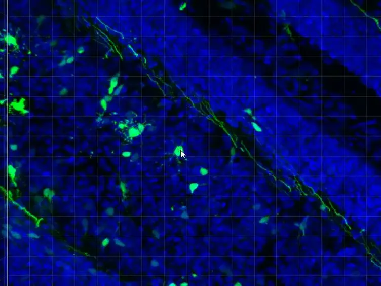 Genetic Manipulation of Cerebellar Granule Neurons <em>In Vitro</em> and <em>In Vivo</em> to Study Neuronal Morphology and Migration