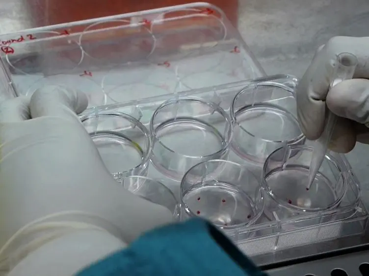 Methodology for the Efficient Generation of Fluorescently Tagged Vaccinia Virus Proteins