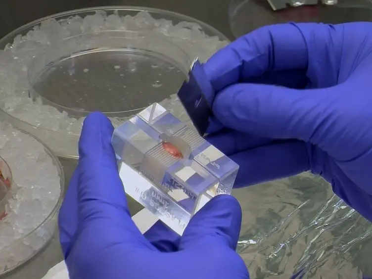 Systemic Injection of Neural Stem/Progenitor Cells in Mice with Chronic EAE