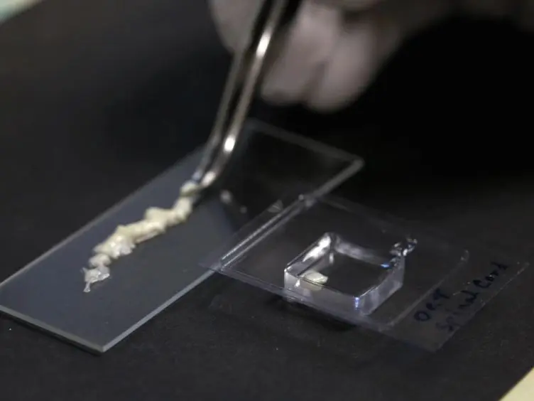 Production of RNA for Transcriptomic Analysis from Mouse Spinal Cord Motor Neuron Cell Bodies by Laser Capture Microdissection