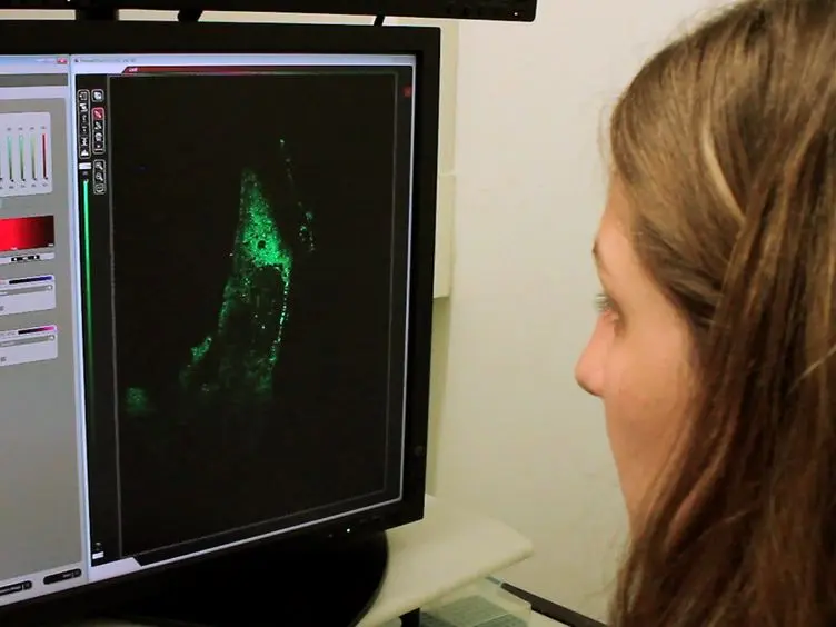 Visualization of G3BP Stress Granules Dynamics in Live Primary Cells