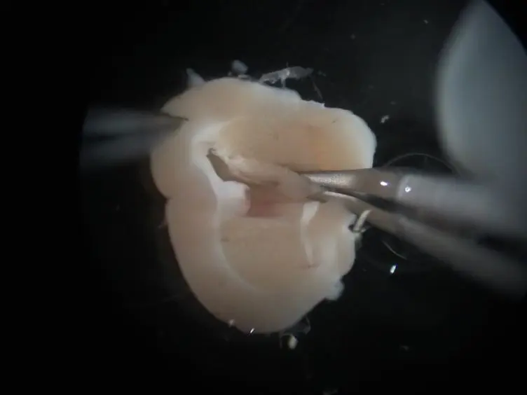 One Mouse, Two Cultures: Isolation and Culture of Adult Neural Stem Cells from the Two Neurogenic Zones of Individual Mice