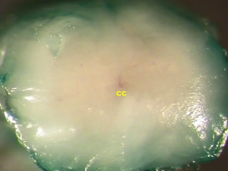 <em>In Vivo</em> SiRNA Transfection and Gene Knockdown in Spinal Cord <em>via</em> Rapid Noninvasive Lumbar Intrathecal Injections in Mice