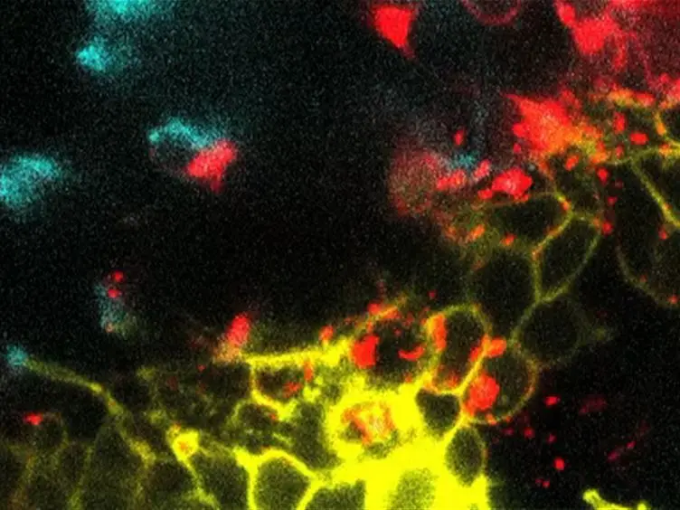 Imaging Through the Pupal Case of <em>Drosophila melanogaster</em>