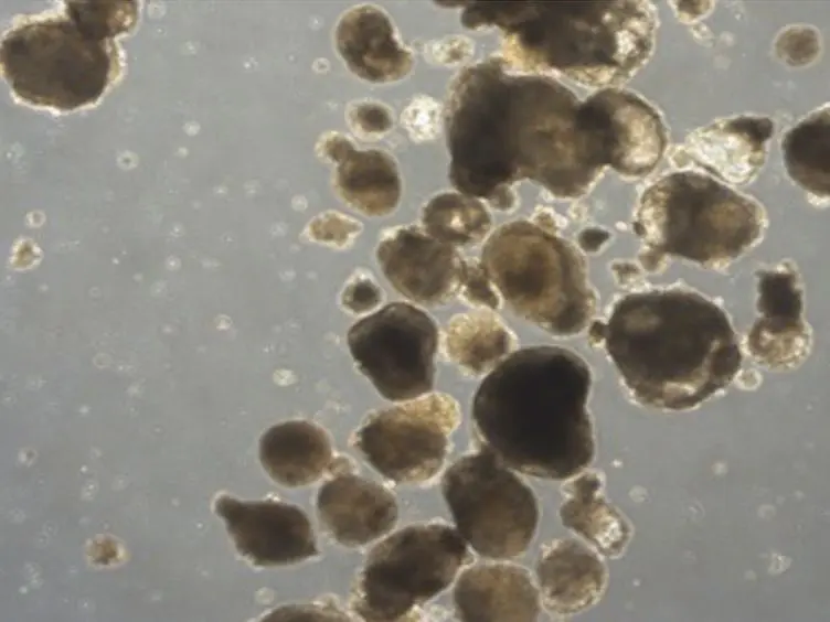 Generation of Myospheres From hESCs by Epigenetic Reprogramming