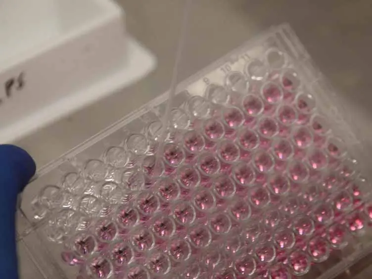 Using RNA-interference to Investigate the Innate Immune Response in Mouse Macrophages